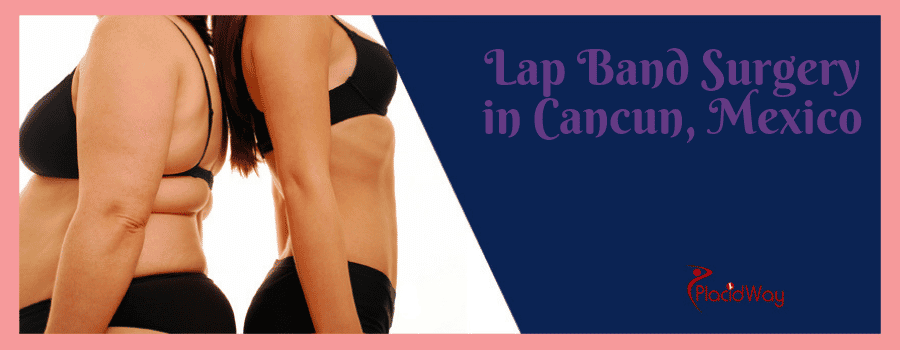 Lap Band Surgery in Cancun, Mexico